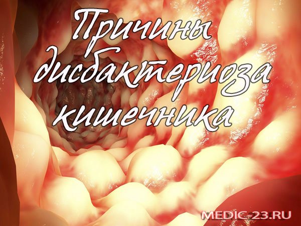 Признаки дисбактериоза кишечника